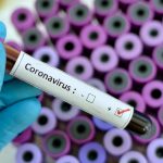 Covid-19 Hastalığını Atlattıktan Sonra Neler Oluyor?