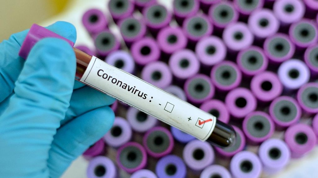 Covid-19 Hastalığını Atlattıktan Sonra Neler Oluyor?