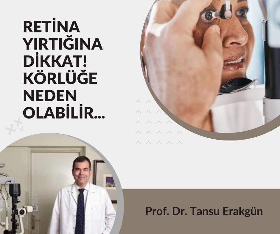 Retina Yırtığına Dikkat! Körlüğe Neden Olabilir…