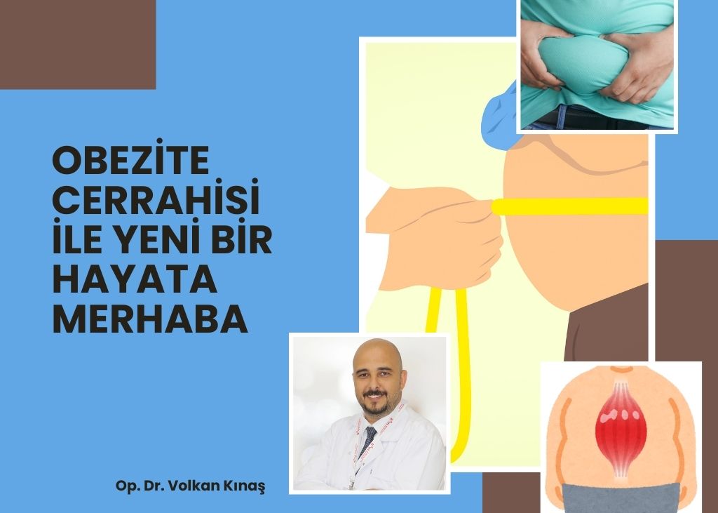 Obezite Cerrahisi ile Yeni Bir Hayata Merhaba