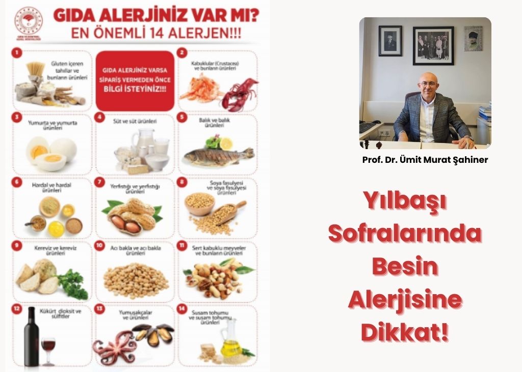 Yılbaşı Sofralarında Besin Alerjisine Dikkat!